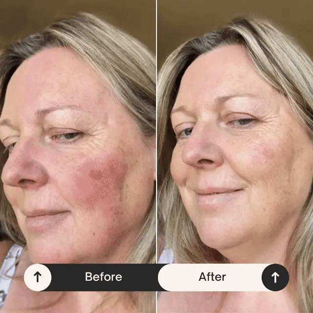 Tavilo™ THERAPY WAND