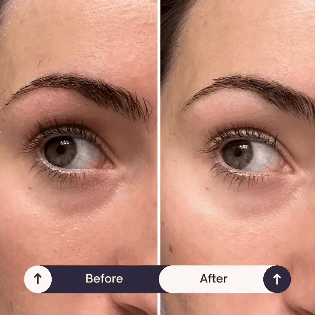 Tavilo™ 24K Under Eye Patches | (5 Sets)